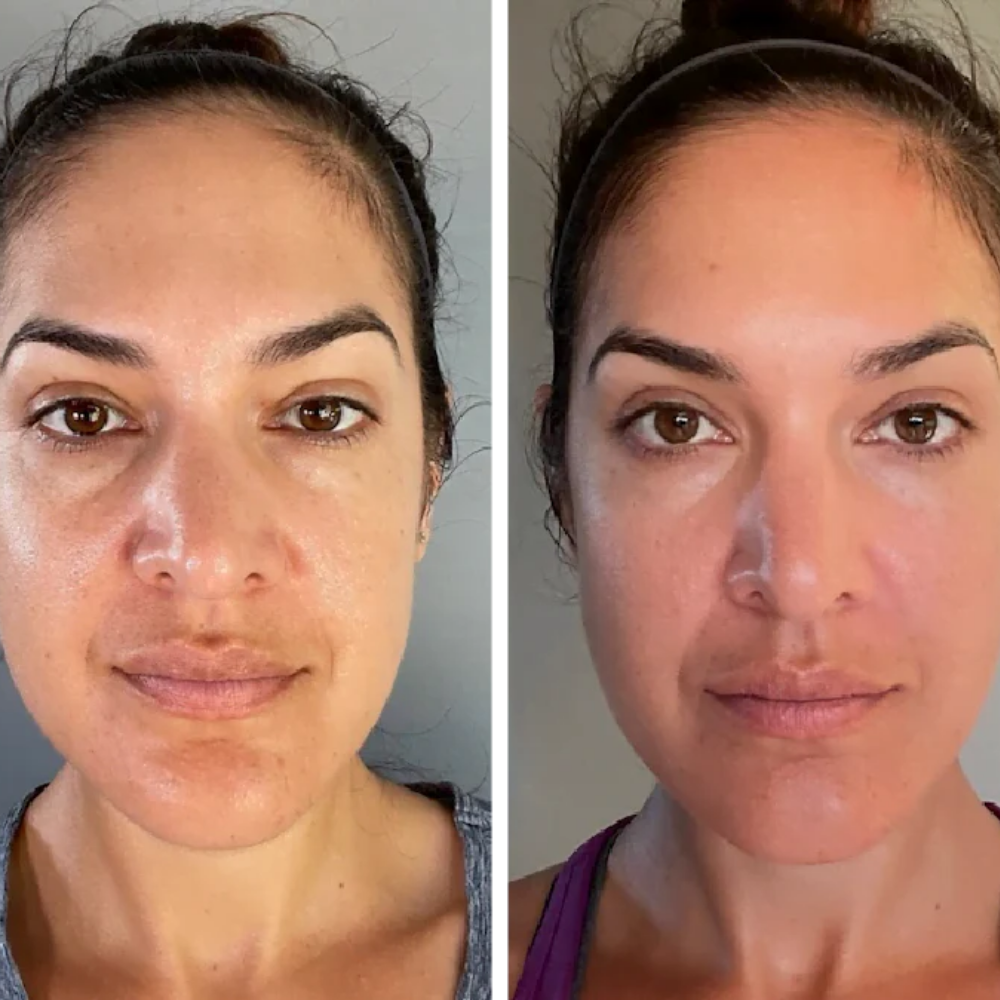 Lumé - EMS Face & Neck Lifter